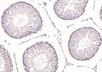 N-Myc Rabbit Polyclonal Antibody