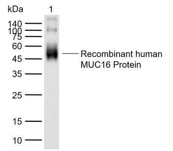 MUC16 Mouse Monoclonal Antibody