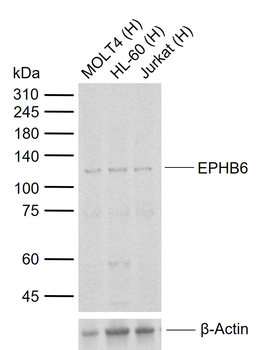EPHB6 Rabbit Polyclonal Antibody