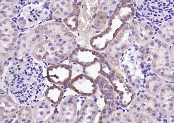 Endostatin Rabbit Polyclonal Antibody