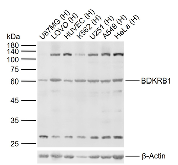 BDKRB1 Rabbit Polyclonal Antibody