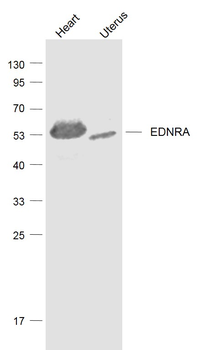 SERPINB1 Rabbit Polyclonal Antibody