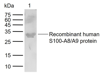 S100-A8 / MRP8 Rabbit Polyclonal Antibody