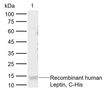 Leptin Rabbit Polyclonal Antibody