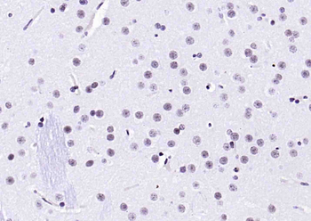 Histone H3 (mono methyl K79) Mouse Monoclonal Antibody