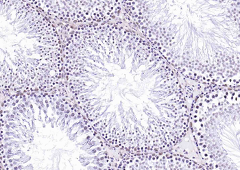 Histone H3 (mono methyl K79) Mouse Monoclonal Antibody