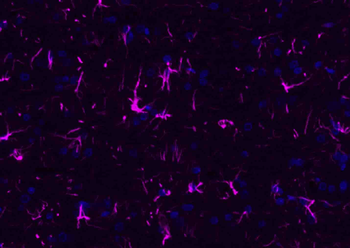 Donkey Anti-Rabbit IgG H&L, BF647 conjugated