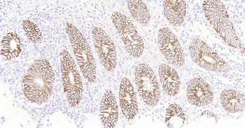 ATP1A1 Ready-To-Use IHC Kit