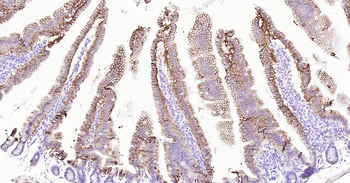 ATP1A1 Ready-To-Use IHC Kit