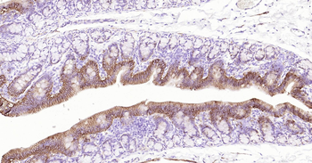 ATP1A1 Ready-To-Use IHC Kit