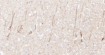 Human NF-L Ready-To-Use IHC Kit