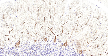 NF-L Ready-To-Use IHC Kit