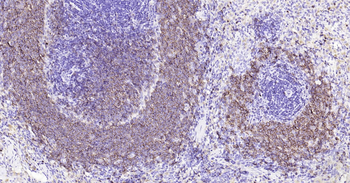 Mouse CD20 Ready-To-Use IHC Kit