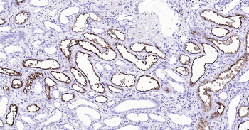Human ACE2 Ready-To-Use IHC Kit