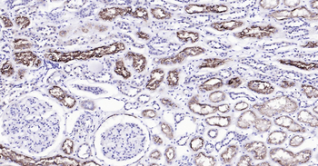 Human ACE2 Ready-To-Use IHC Kit