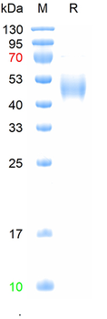 Recombinant human CD19 protein,His (HEK293)