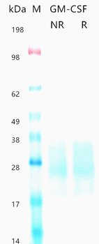 Recombinant human GM-CSF protein (Active, HEK293)