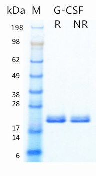 Recombinant human G-CSF protein (Active, CHO)