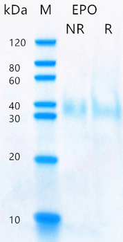Recombinant human EPO protein (Active, HEK293)