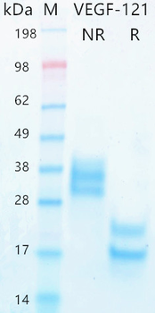Recombinant human VEGF-121 protein (Active, HEK293)
