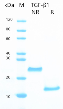Recombinant human TGF-Beta 1 protein (Active, HEK293)