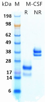 Recombinant human M-CSF protein (Active, HEK293)