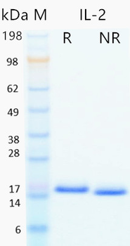 Recombinant human IL-2 protein (Active, HEK293)