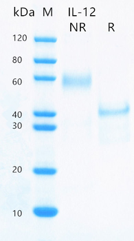 Recombinant human IL-12 protein (Active, HEK293)