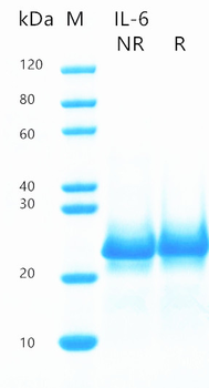 Recombinant human IL-6 protein (Active, HEK293)