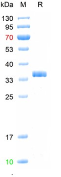 Recombinant human PRL-R protein, C-His (HEK293)