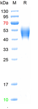 Recombinant mouse IL2RA protein, C-His (HEK293)