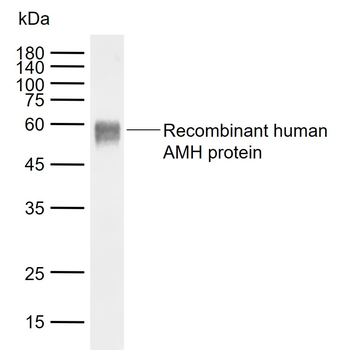 AMH Mouse Monoclonal Antibody
