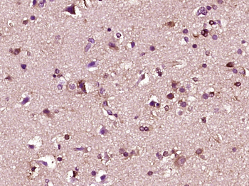 Fbxw7 Rabbit Polyclonal Antibody