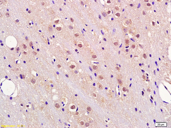 Fbxw7 Rabbit Polyclonal Antibody