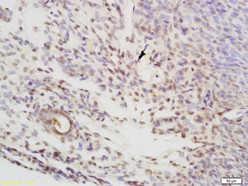 CBX1 Rabbit Polyclonal Antibody