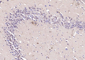 KMT3B Rabbit Polyclonal Antibody