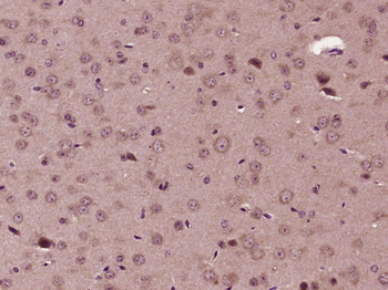 Diazepam Binding Inhibitor Rabbit Polyclonal Antibody