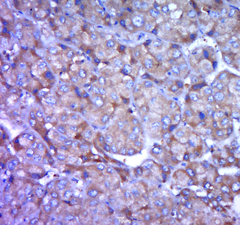 ADH1B Rabbit Polyclonal Antibody