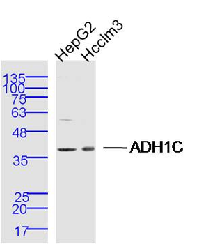 ADH1C Rabbit Polyclonal Antibody