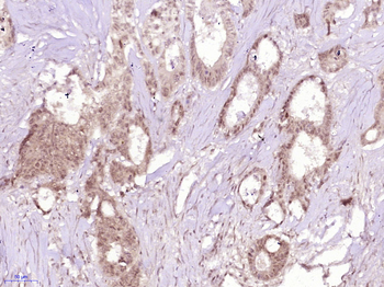 Phospho-AMPK alpha 1 (Thr183) + AMPK alpha 2 (Thr172) Rabbit Polyclonal Antibody