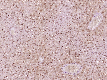 Phospho-AMPK alpha 1 (Thr183) + AMPK alpha 2 (Thr172) Rabbit Polyclonal Antibody