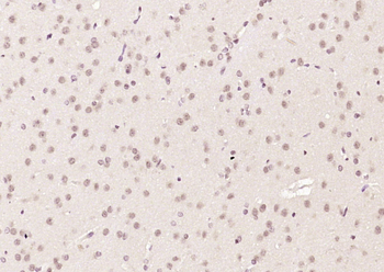 Ataxin 3 Rabbit Polyclonal Antibody