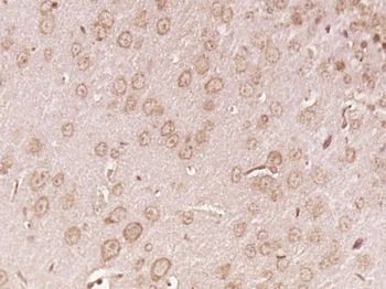 ABCD2 Rabbit Polyclonal Antibody