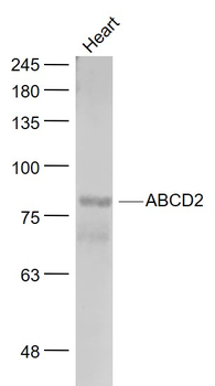ABCD2 Rabbit Polyclonal Antibody