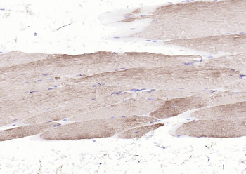 Actin Rabbit Polyclonal Antibody