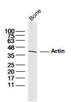 Actin Rabbit Polyclonal Antibody