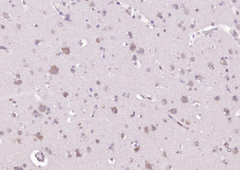 B4GALNT1/GM2 synthase Rabbit Polyclonal Antibody