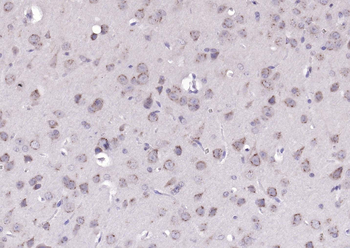 B4GALNT1/GM2 synthase Rabbit Polyclonal Antibody