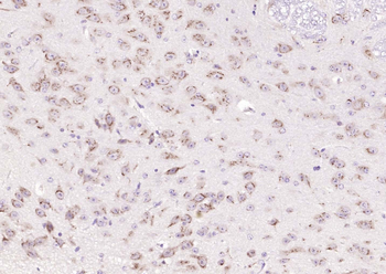 B4GALNT1/GM2 synthase Rabbit Polyclonal Antibody
