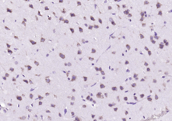 B4GALNT1/GM2 synthase Rabbit Polyclonal Antibody